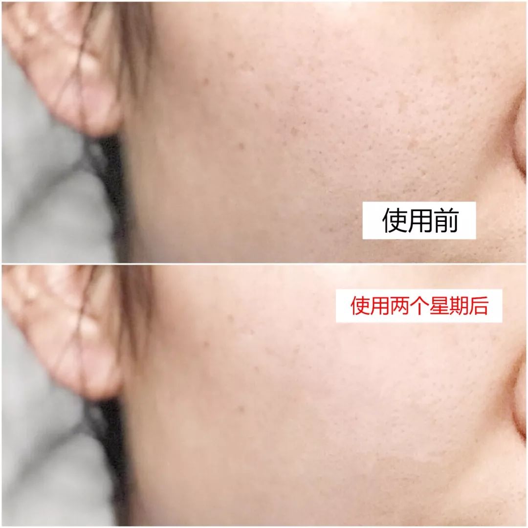 欧诗漫面膜怎么样好不好,面膜排行榜前十名推荐,欧诗漫面膜怎么样